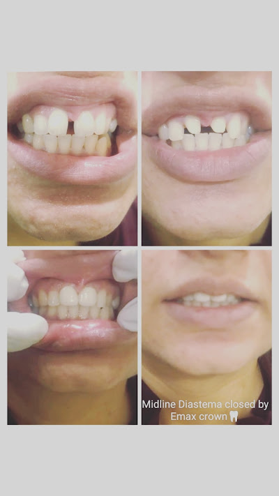 Modern Dental Equipment